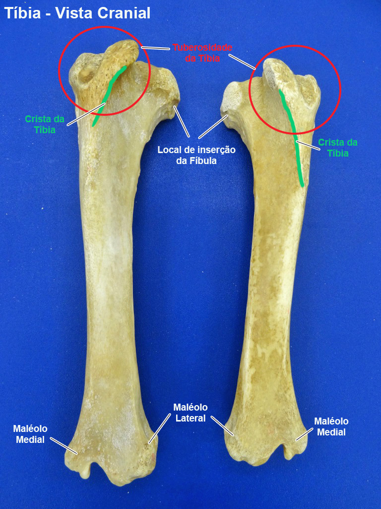 Tibia Fibula Anatomia Veterin Ria I