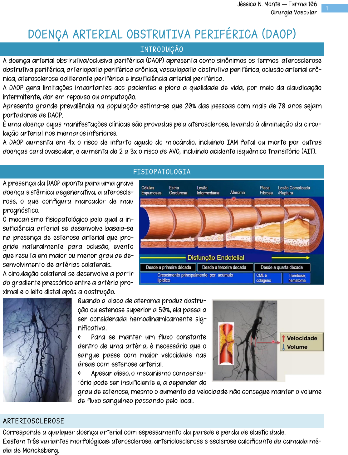 DoenÇa Arterial Obstrutiva PerifÉrica Cirurgia Vascular 