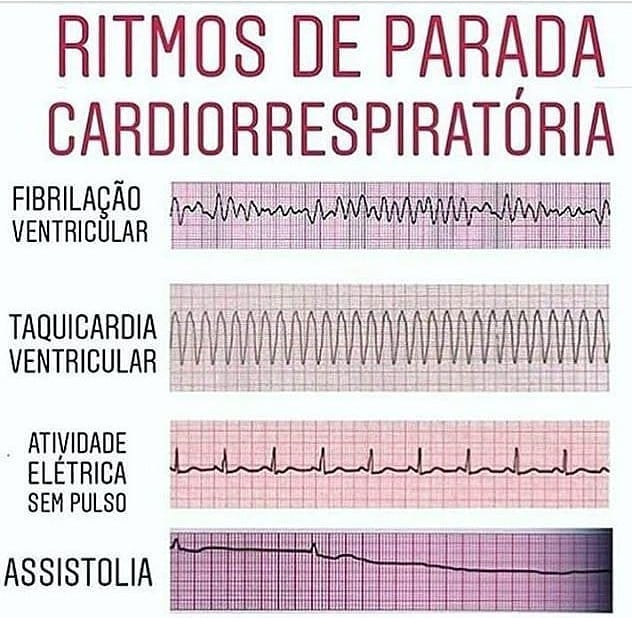 Ritmos Cardíacos Anatomia I 