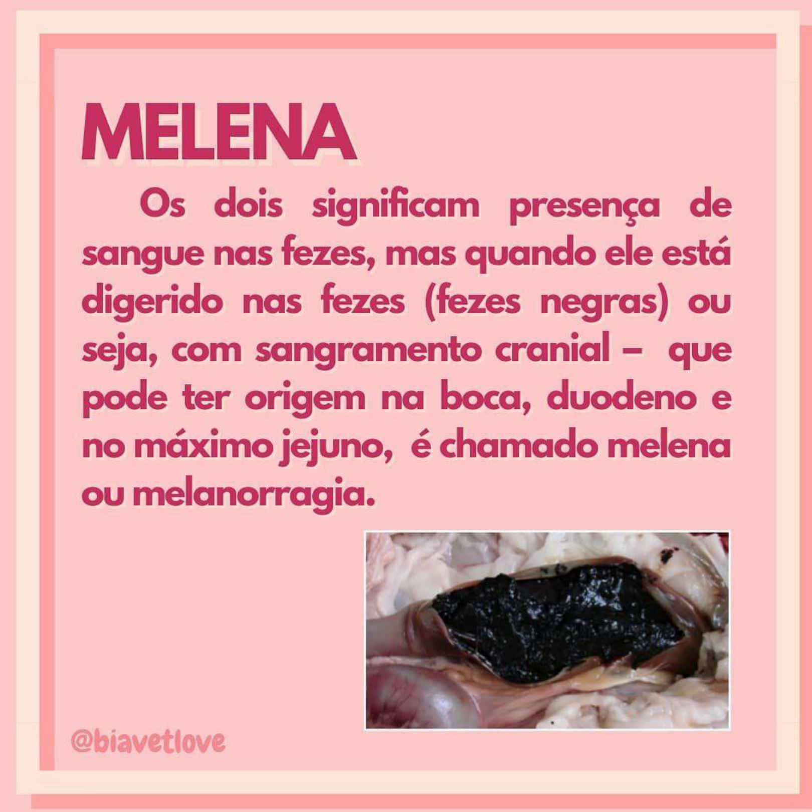 Diferença Entre Hematoquezia E Melena - Patologia - Patologia I