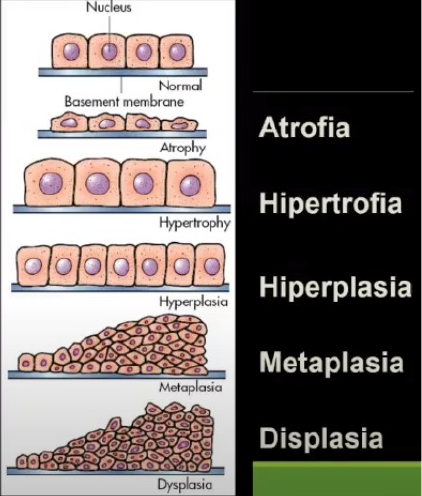 atrofia celular