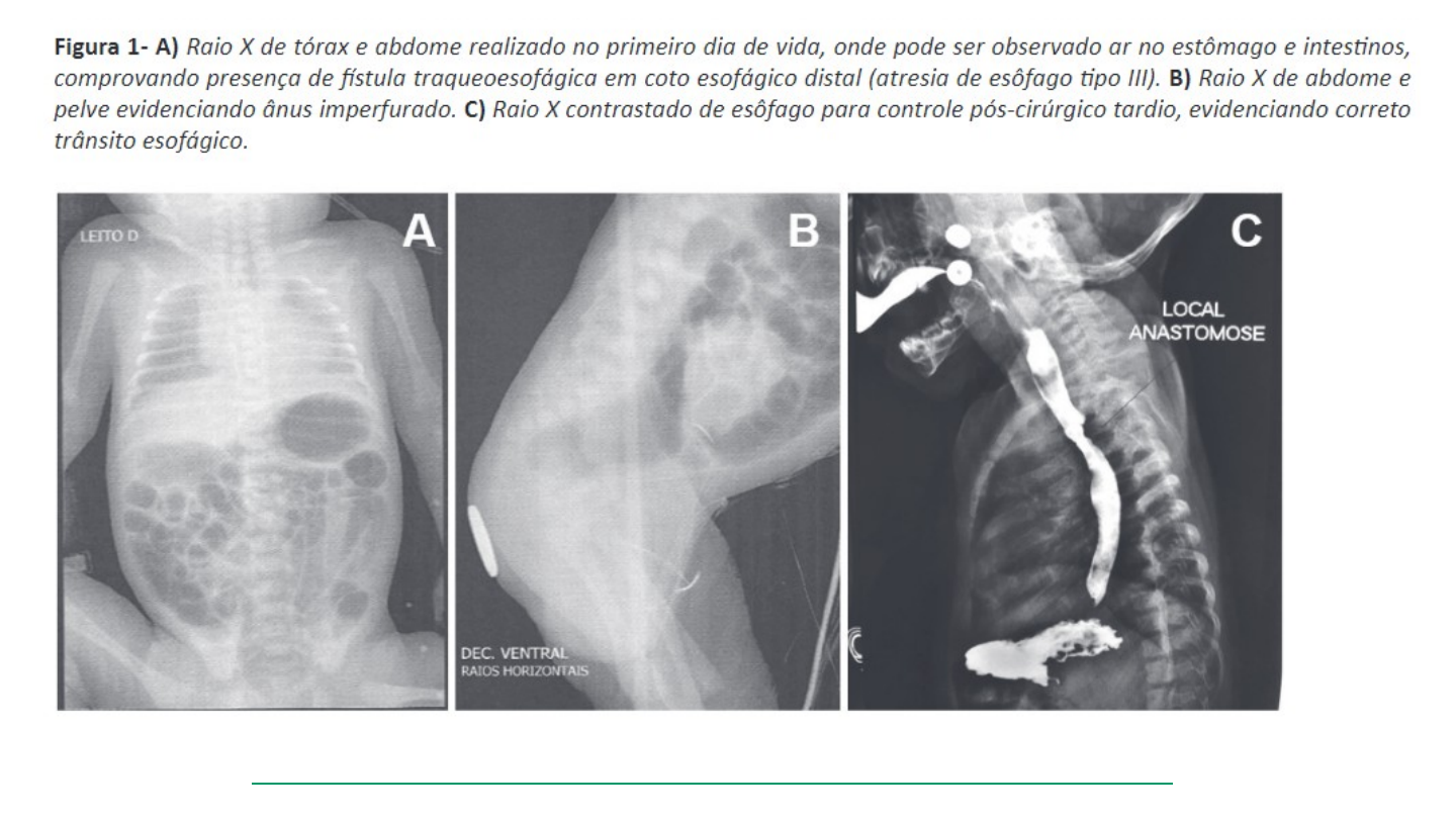 Grátis: Sistema Digestório 1 - Esôfago e Estômago - Material Claro e  Objetivo em PDF para Estudo Rápido