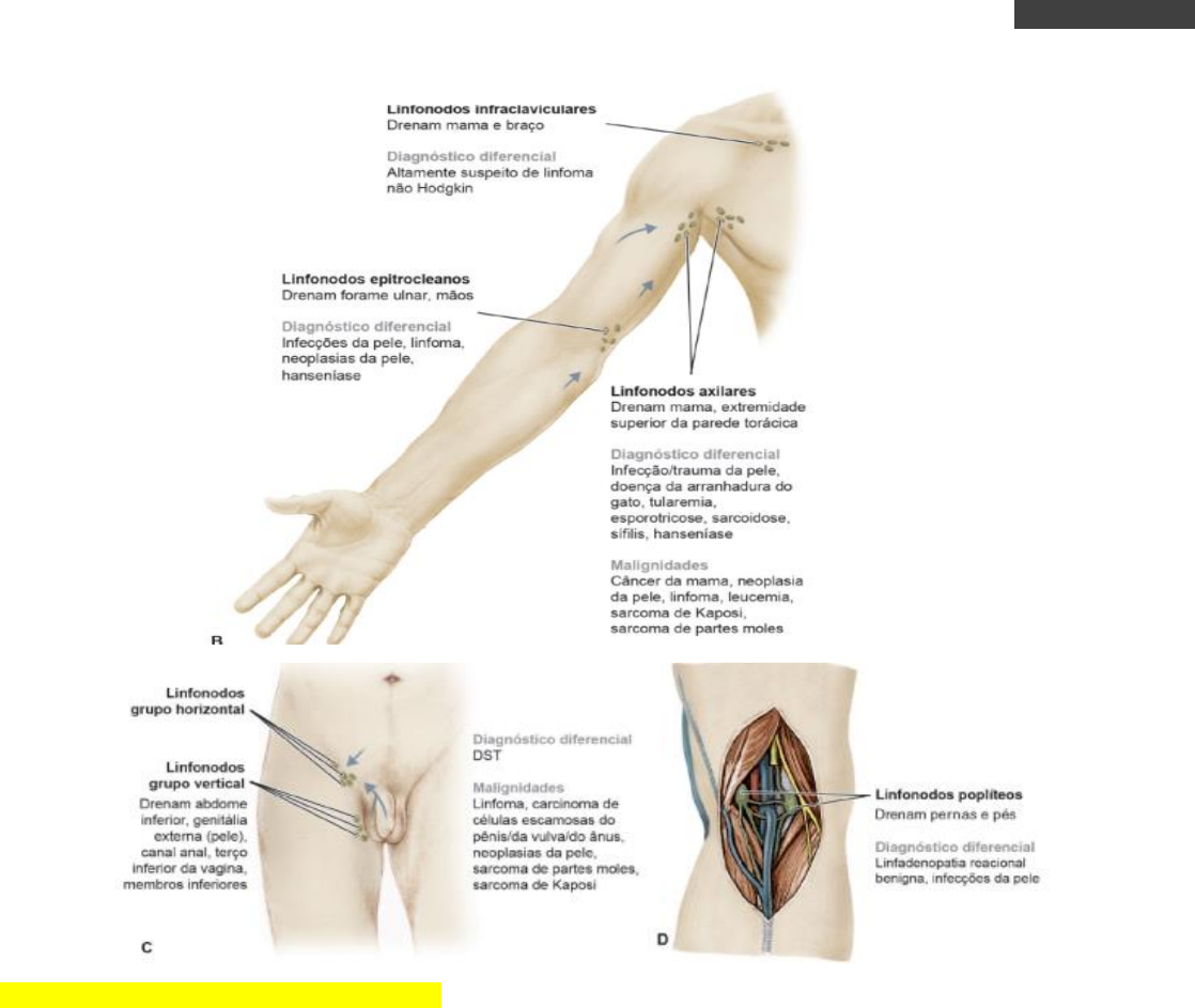Grátis: ABORDAGEM DO PACIENTE COM LINFONODOMEGALIAS - Material Claro e  Objetivo em PDF para Estudo Rápido, image size:1118x943