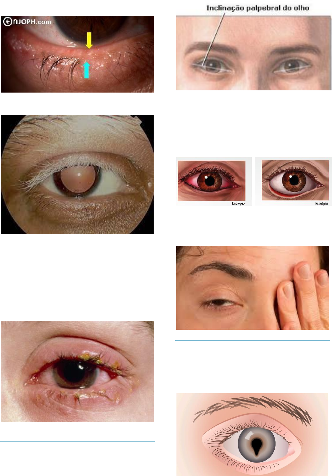 Grátis: Exame Físico da Cabeça - Material Claro e Objetivo em PDF para  Estudo Rápido, image size:1059x1517