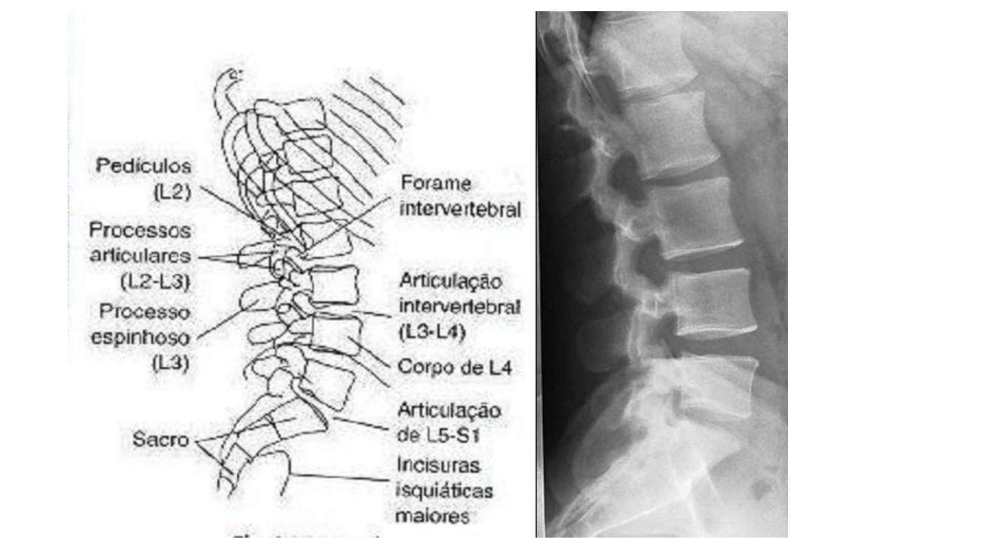 Grátis: COLUNA LOMBAR - Material Claro e Objetivo em PDF para Estudo Rápido, image size:1920x1080