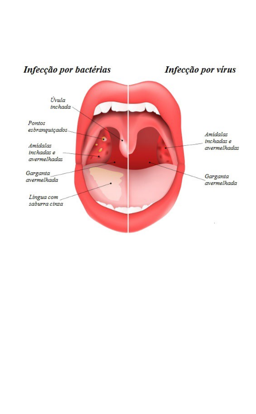 Grátis: Amidalite - Material Claro e Objetivo em PDF para Estudo Rápido, image size:851x1378