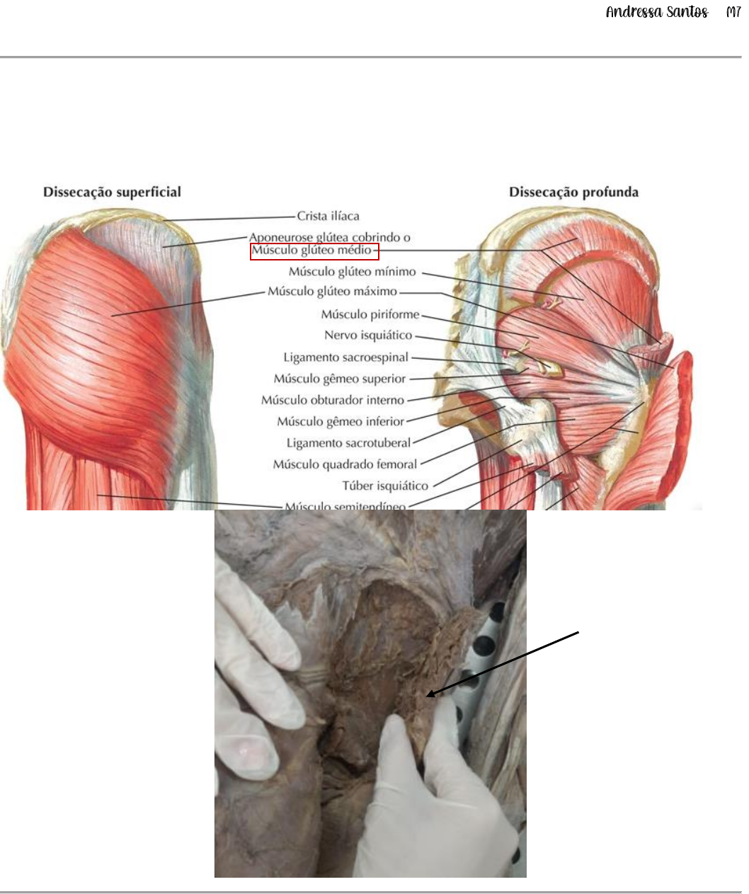 Gluteal Muscles Labeled