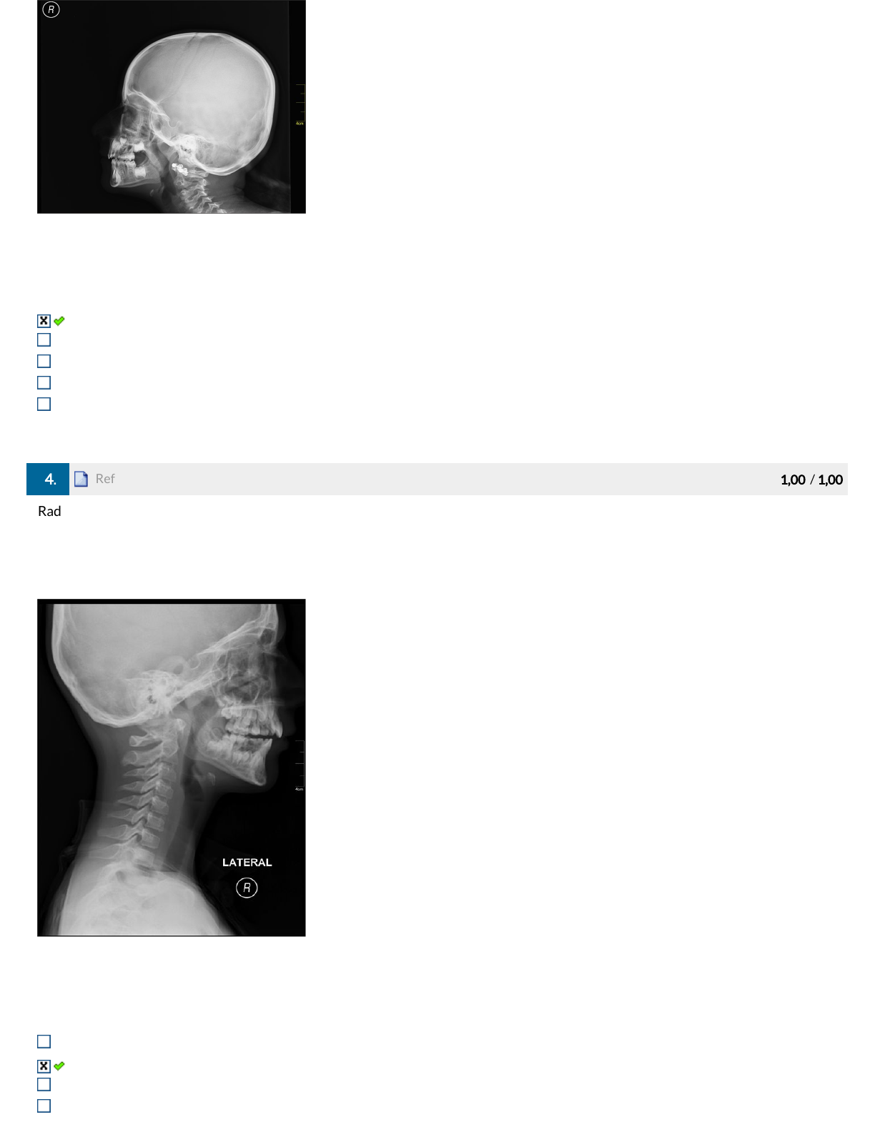Estácio Alunos(1) - Anatomia Radiológica