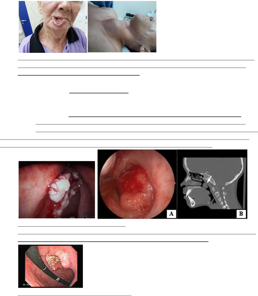 Missao de remocao de cisto a laser Solucoes de ponta como a remocao de cisto  a laser esta revolucionando a saude - FasterCapital, image size:1046x1199