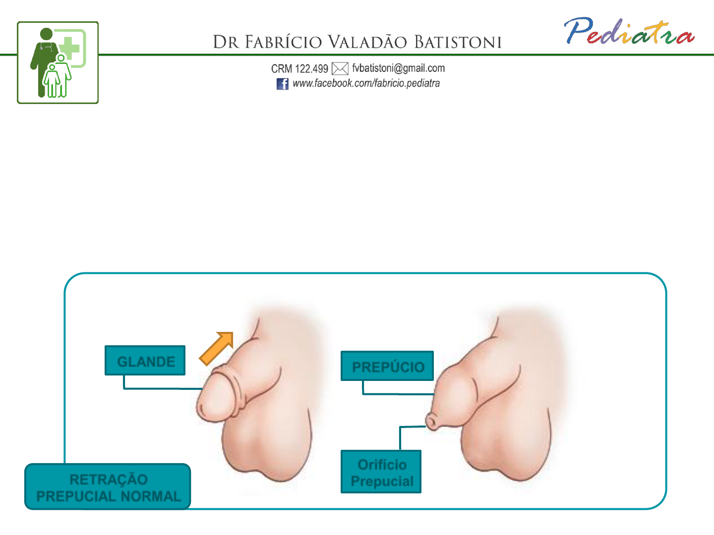 Fimose Pediatria I