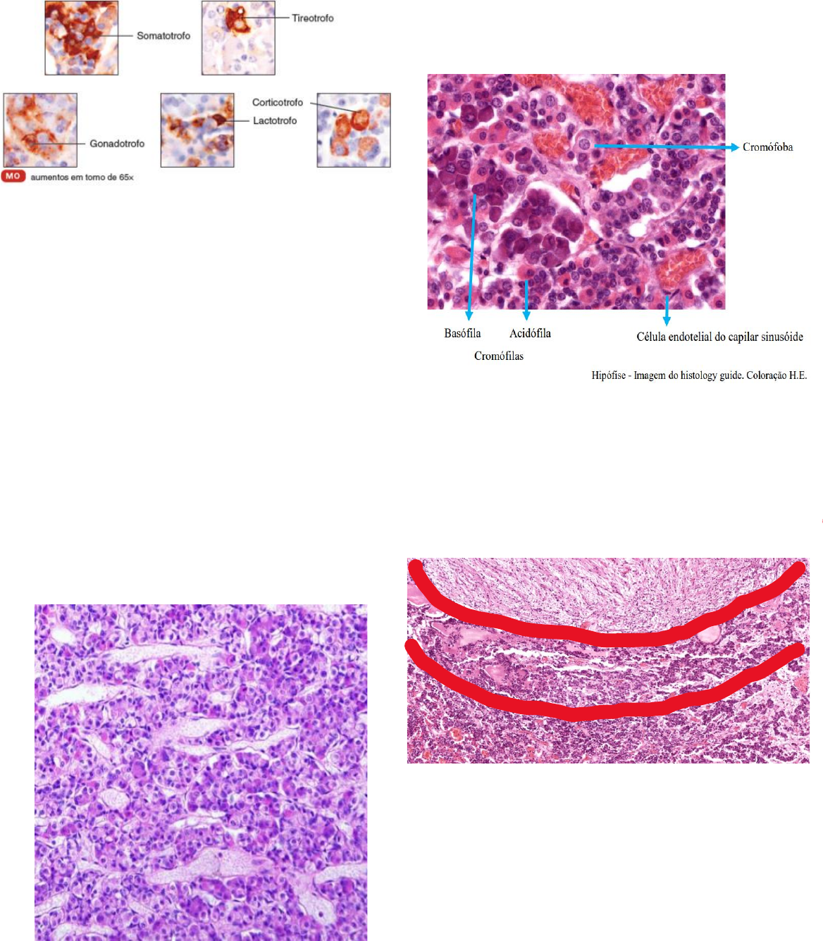 Histologia Da Hipofise Anterior Rotulada Histologia Da Hipófise