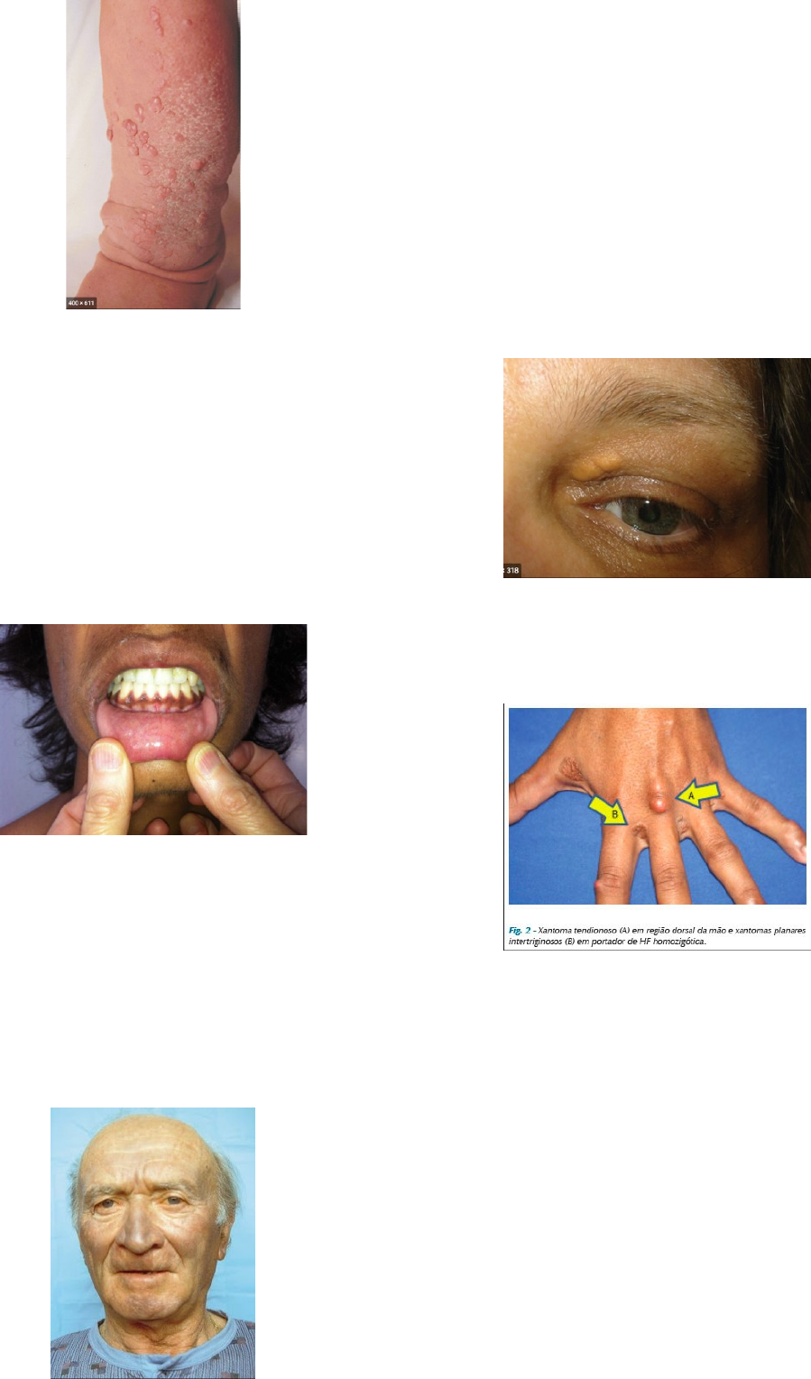 Grátis: Manifestacoes cutaneas de doencas sistêmicas - Material Claro e  Objetivo em PDF para Estudo Rápido, image size:899x1529