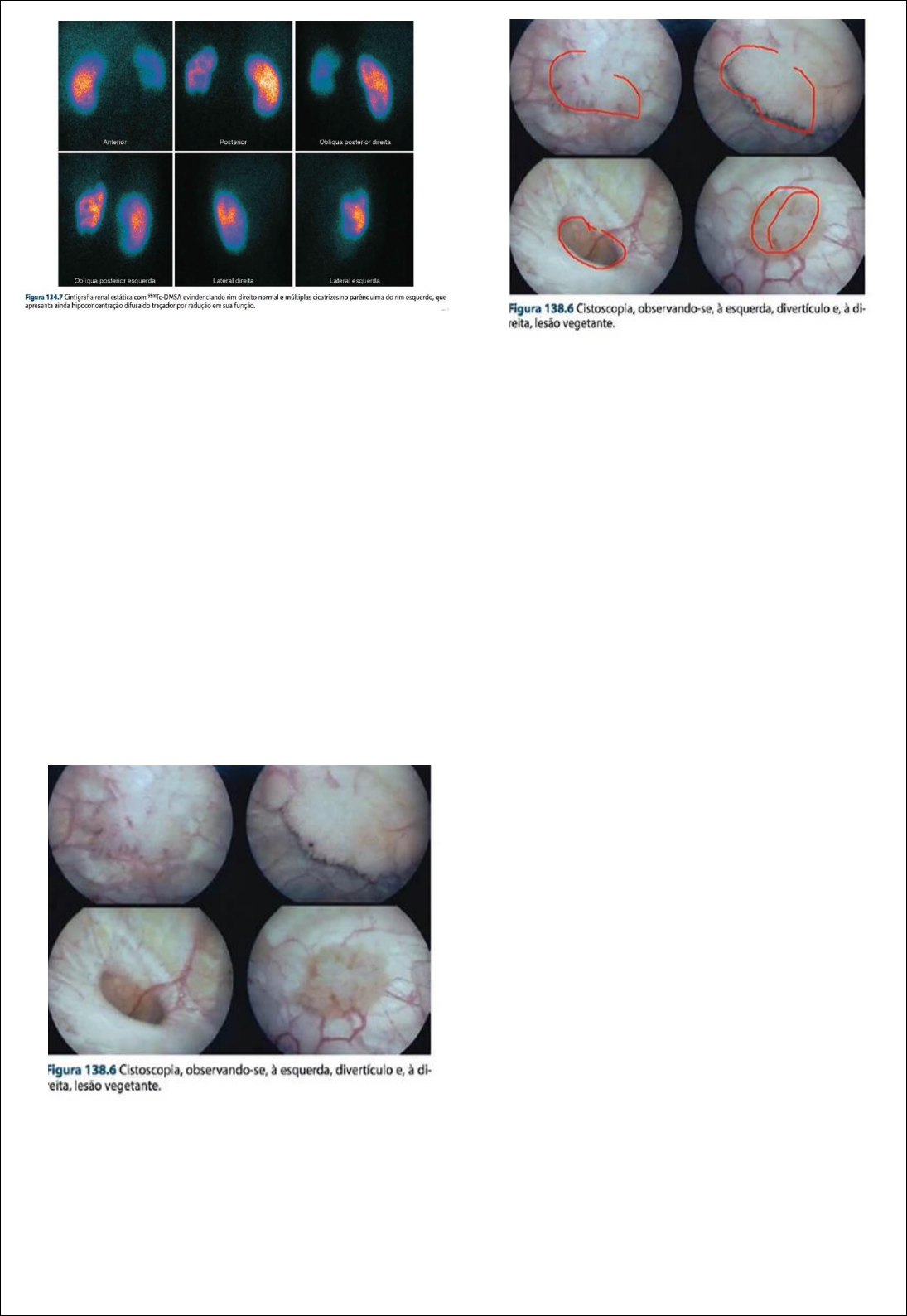 Semiologia renal (1) - Semiologia Médica