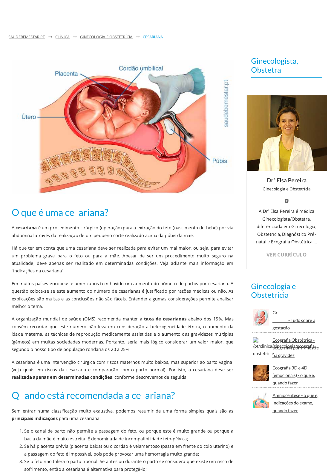 Cesariana - indicações, riscos, como é feita, recuperação após parto -  Ginecologia e Obstetrícia