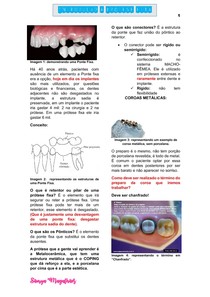 MANUAL DE PRÓTESE FIXA COMPLETO, DE INTRODUÇÃO À CIMENTAÇÃO, MAIS DOIS ASSUNTOS EXTRA