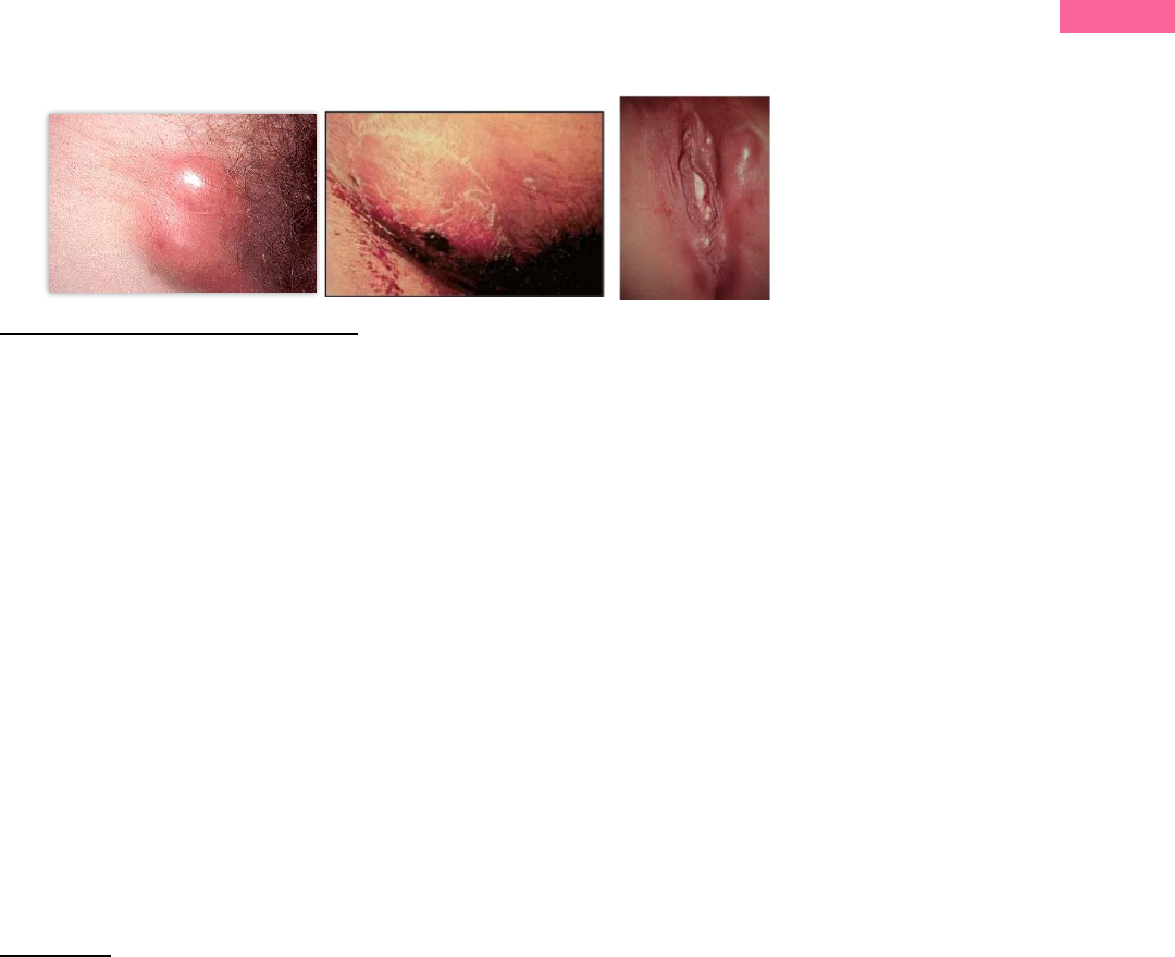 Grátis: Seminário IST II Doenças granulomatosas - Material Claro e Objetivo  em PDF para Estudo Rápido, image size:1080x880