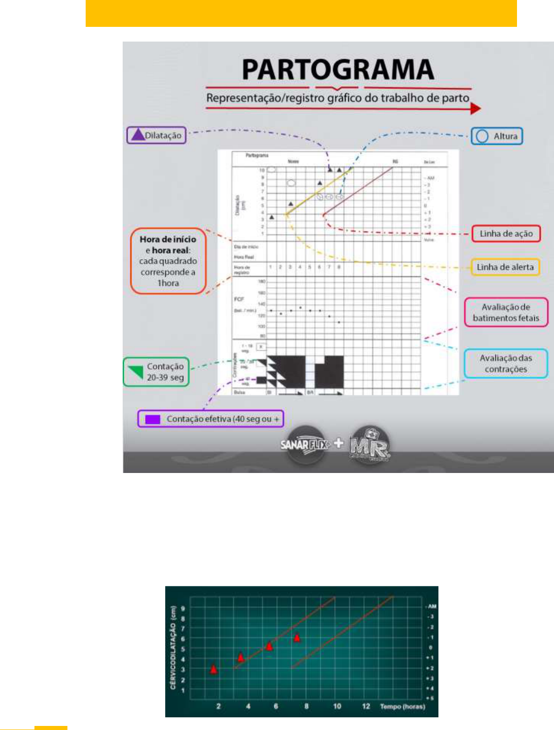 Umbigo do Bebê: O Que Fazer Quando Demora para Cair?, image size:1093x1440