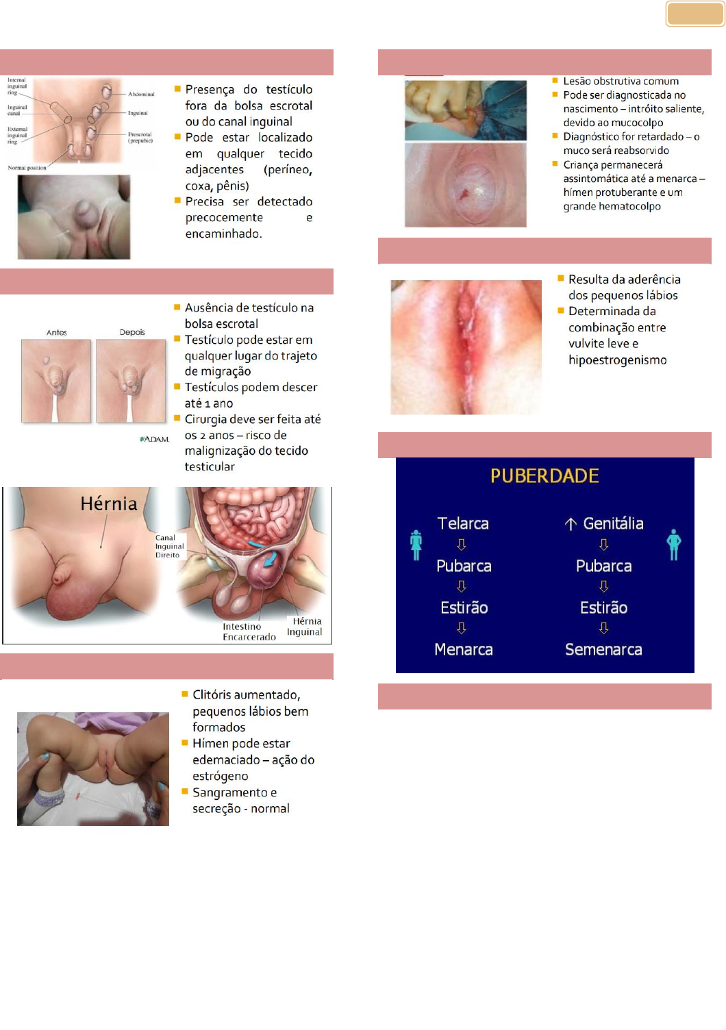 EXAME FÍSICO DOS ÓRGÃOS SEXUAIS FEMININOS E MASCULINOS - Pediatria I