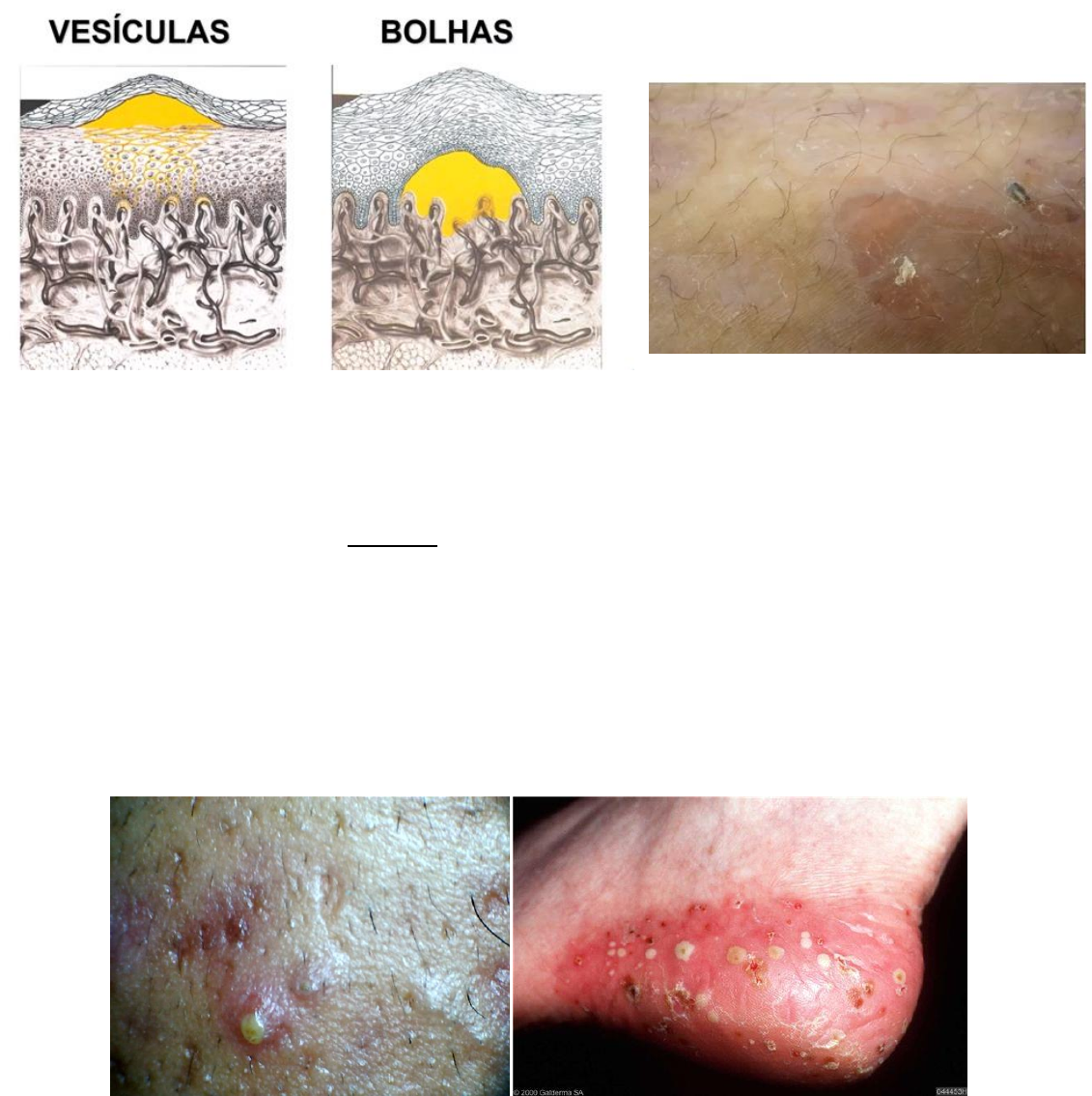 INU - Você já ouviu falar das glândulas de Tyson? São pequenas estruturas no  pênis que ficam entre a glande e o prepúcio e se parecem com espinhas  esbranquiçadas; na maioria dos, image size:1131x1134