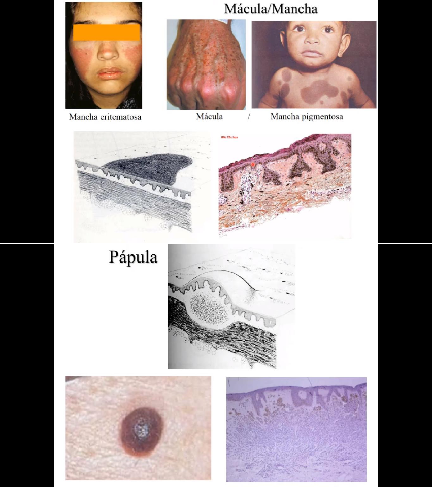 Dra Patricia Canelas - As Glândulas de Tyson são estruturas do pênis que  estão presentes em todos os homens, na região em volta da glande. Estas  glândulas são responsáveis por produzir um, image size:851x961