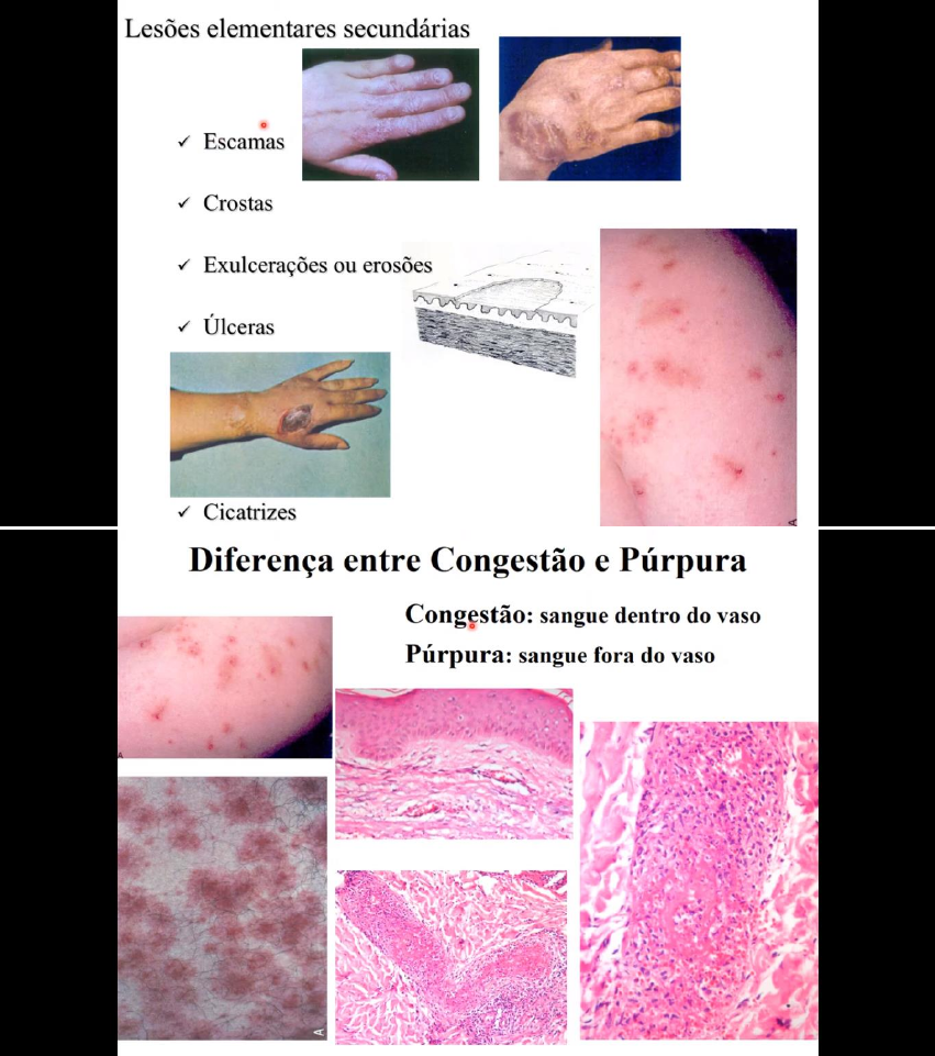 Grátis: TUMORES DA PELE - Material Claro e Objetivo em PDF para Estudo  Rápido, image size:851x961