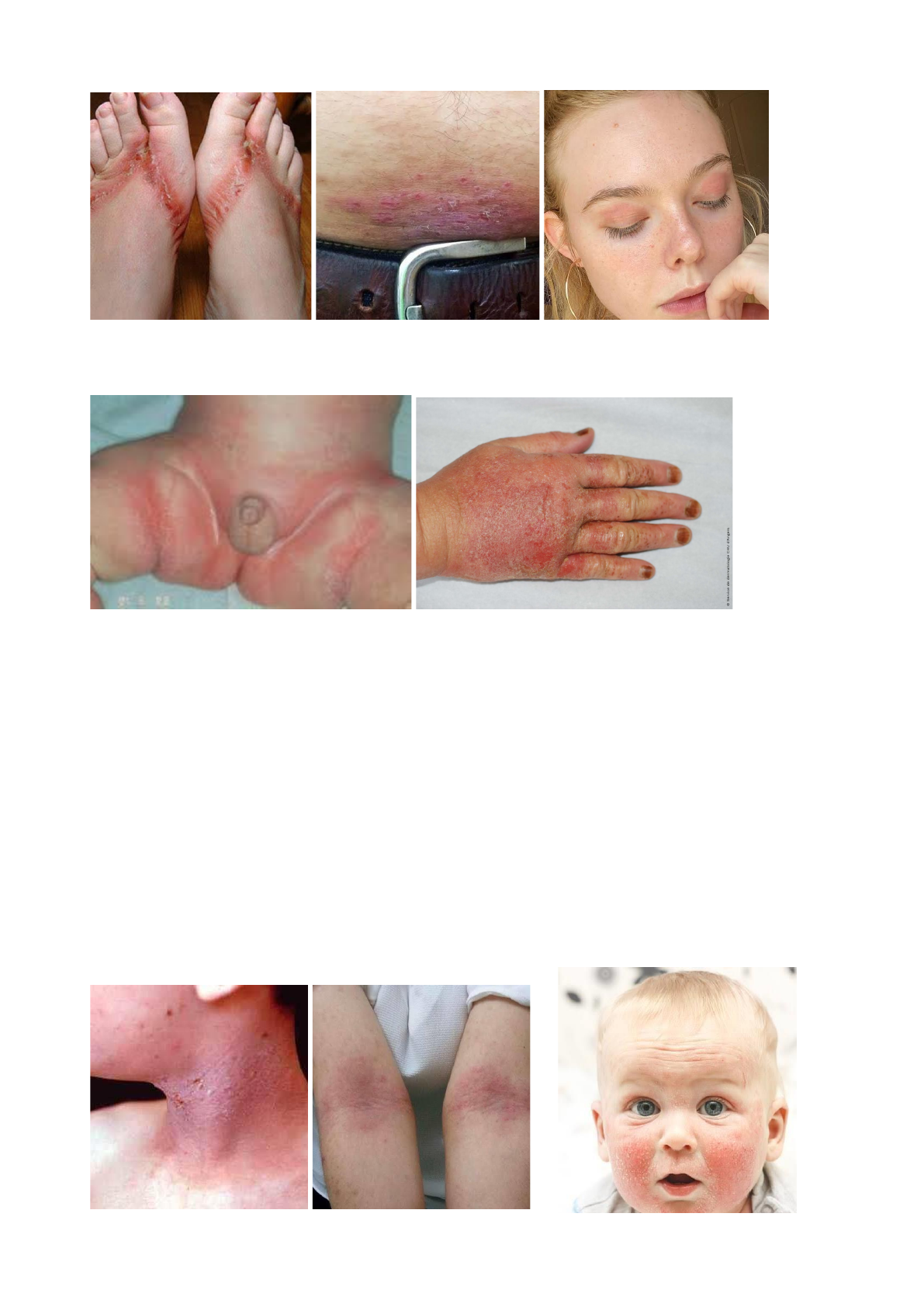 Grátis: Lesões eczematosas - Material Claro e Objetivo em PDF para Estudo  Rápido, image size:1191x1684