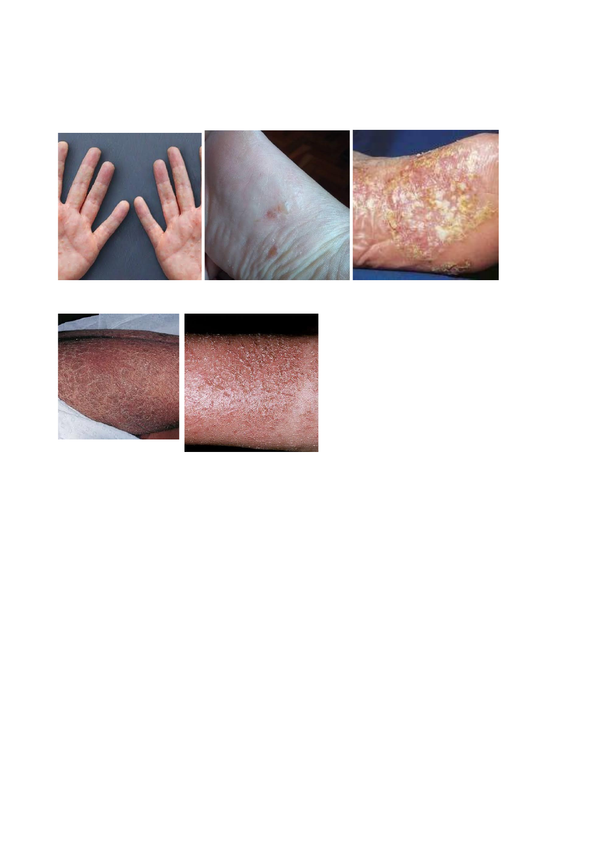 Grátis: Lesões eczematosas - Material Claro e Objetivo em PDF para Estudo  Rápido, image size:1191x1684