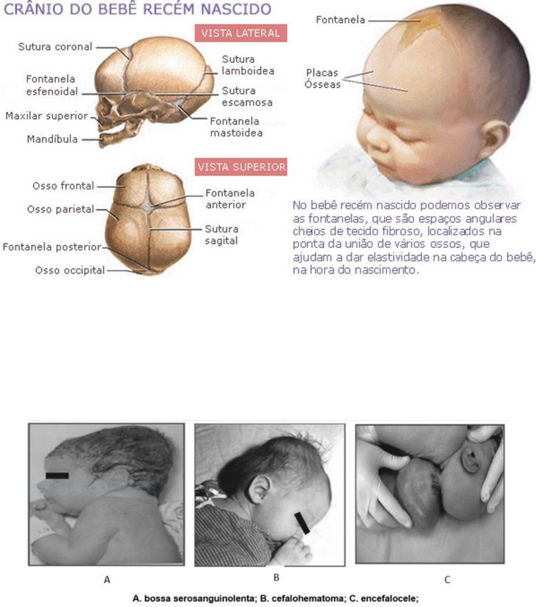 Grátis: Avaliação do RN - Material Claro e Objetivo em PDF para Estudo  Rápido, image size:1047x1186