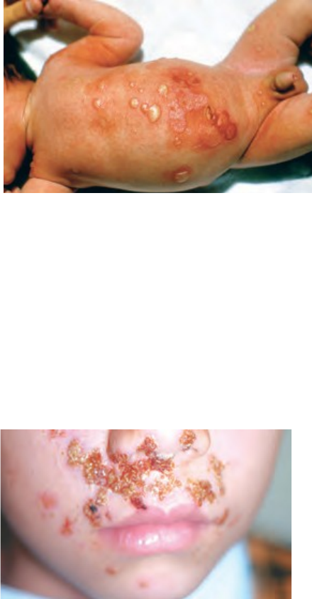 Dermatologia Pediátrica - Pediatria I