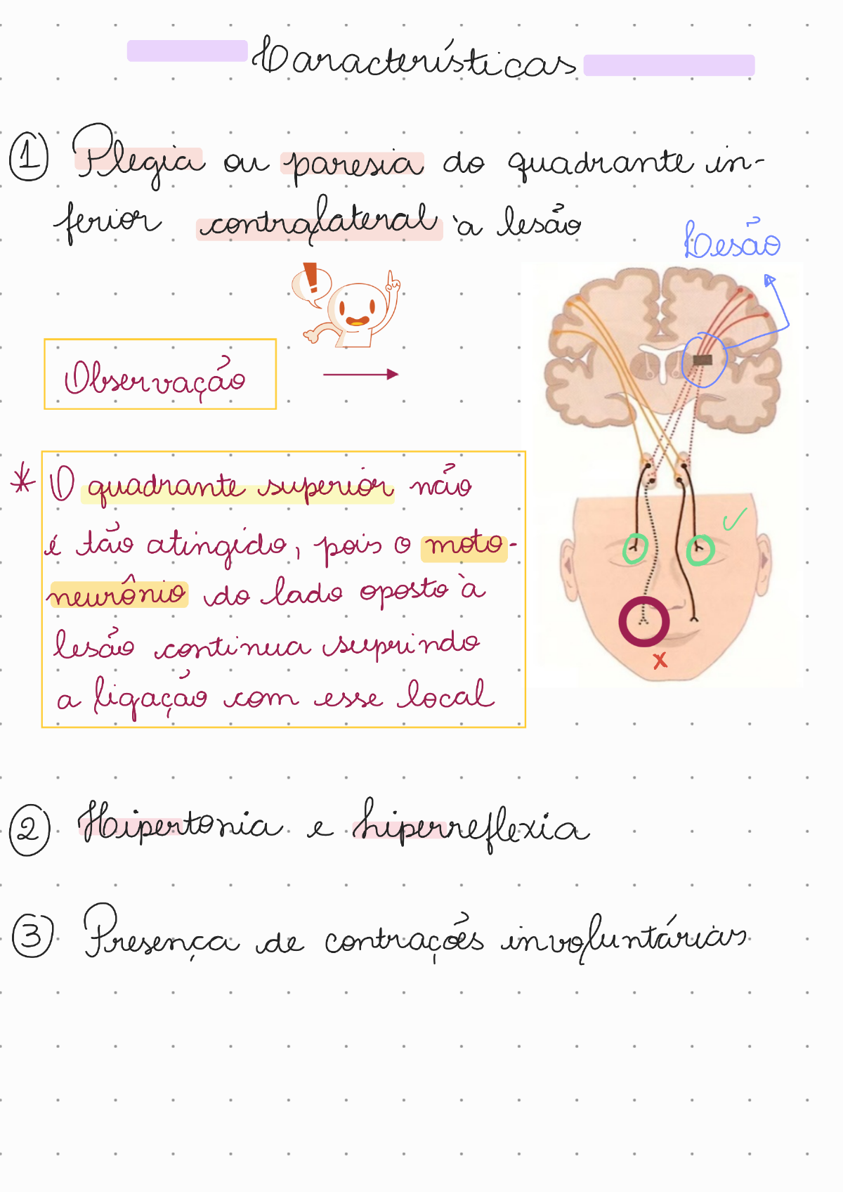 Resumo Paralisia Facial - Passei Direto - Neurologia