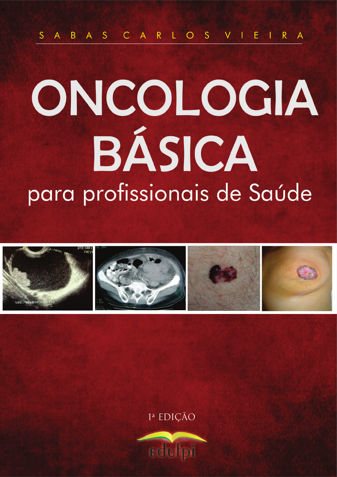 Glóbulos vermelhos baixos: o que significa? - Oncocenter