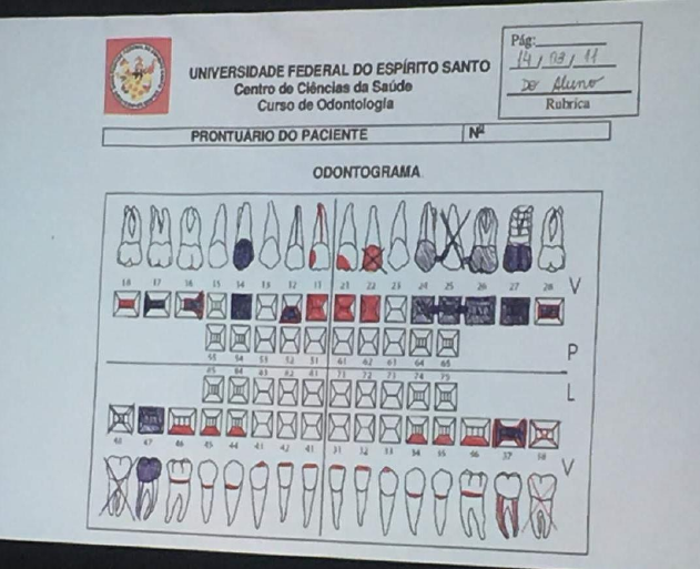 Odontograma: o que é, o melhor modelo e como preencher