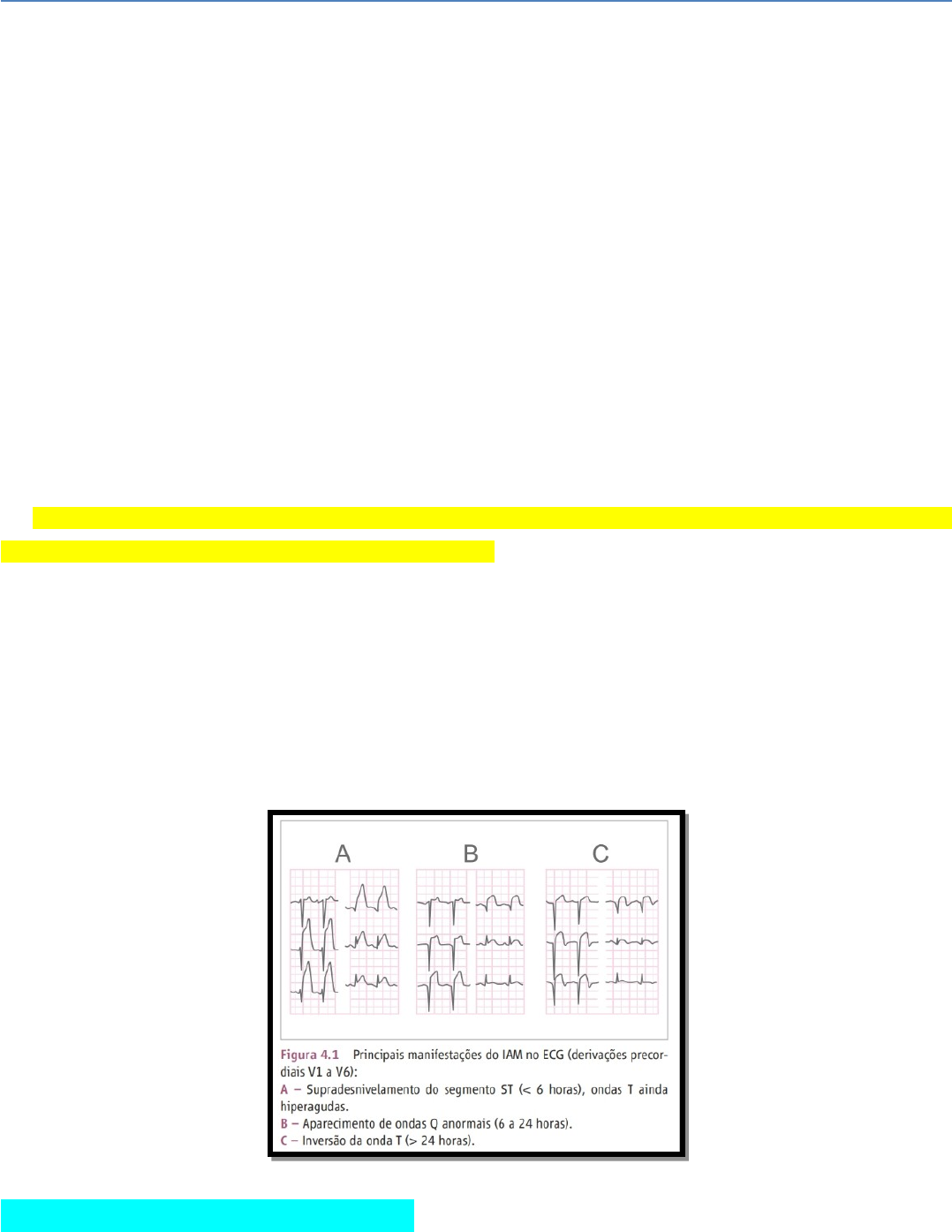 PPT - Diagnóstico Diferencial da Dor Torácica Aguda PowerPoint Presentation  - ID:1272111, image size:1078x1395
