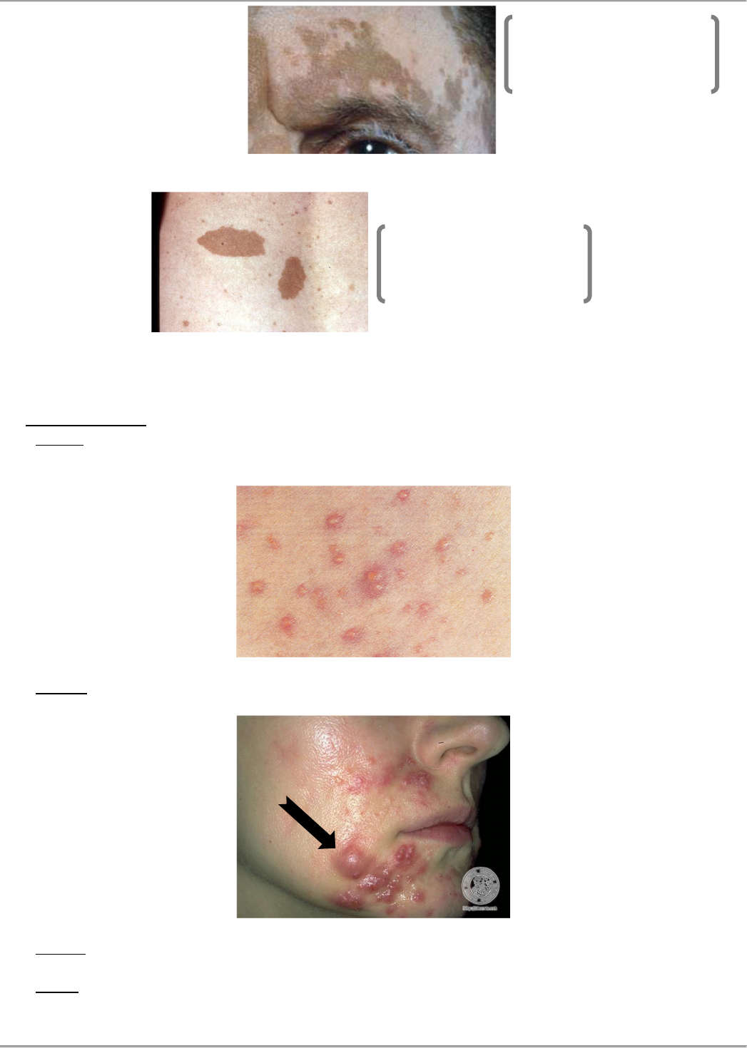 Dermatologia - Resumao Completo - Dermatologia