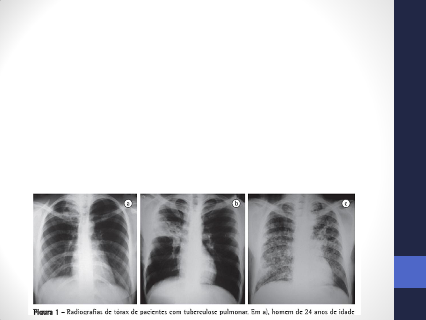 AULA RX de Torax PDF | PDF | Ciências e Matemática, image size:1440x1080