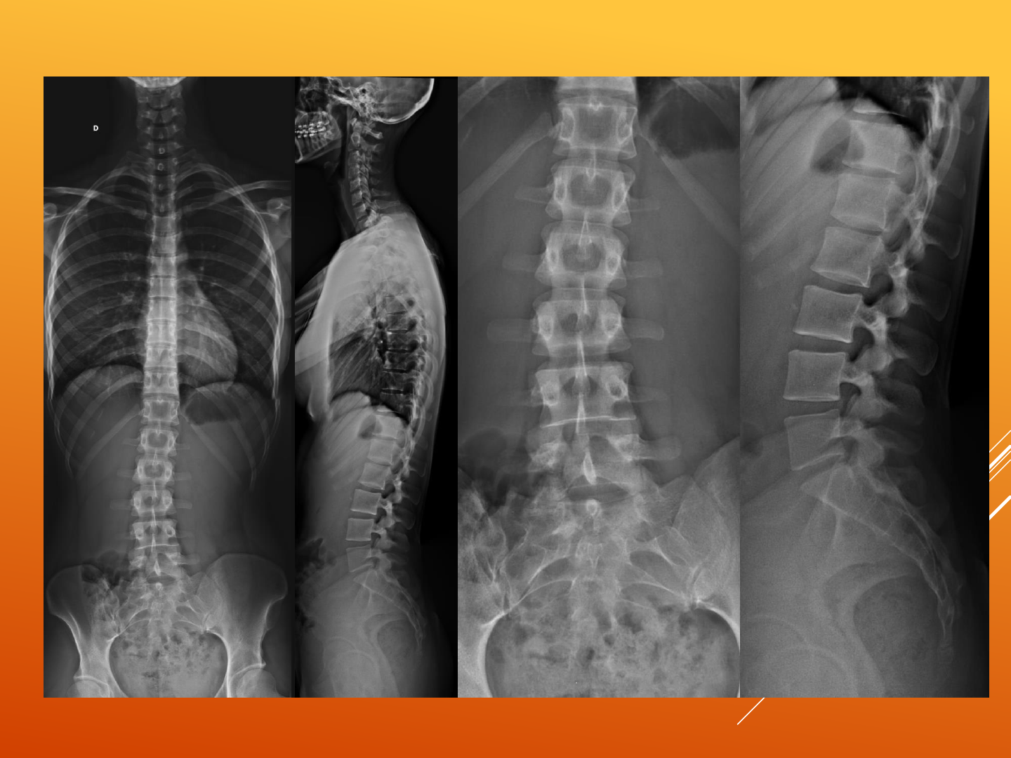 Grátis: Posicionamento Coluna Vertebral - Professor Natan de Almeida -  Material Claro e Objetivo em PDF para Estudo Rápido, image size:1440x1080