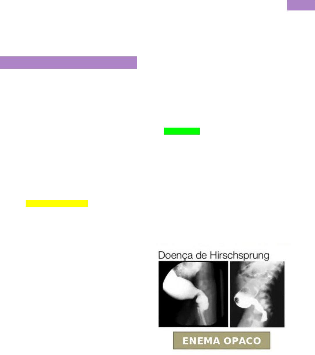Doença de Chron: Causas, Fatores de Risco, Sintomas, Tratamento, image size:1083x1221