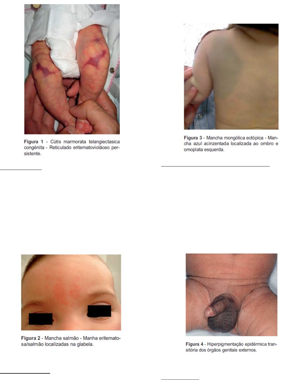 Grátis: Lesões elementares no RN - Material Claro e Objetivo em PDF para  Estudo Rápido