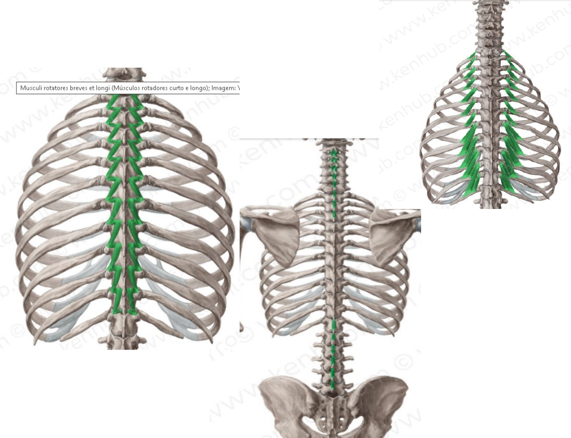 Grátis: ERETORES DA ESPINHA - Material Claro e Objetivo em PDF para Estudo  Rápido, image size:1139x874