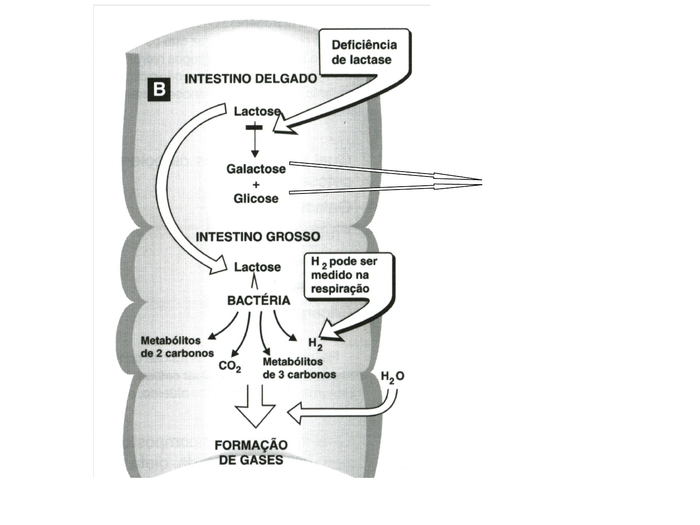 Grátis: digestão, absorção e metabolismo energético de carboidratos -  Material Claro e Objetivo em PDF para Estudo Rápido, image size:1440x1080