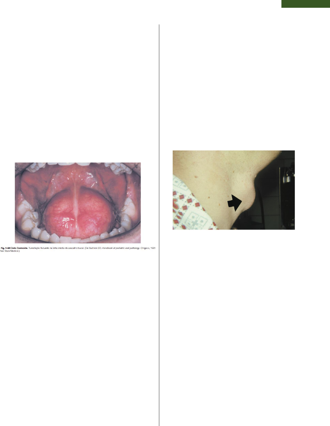 Grátis: Cistos odontogênicos e não odontogênicos - Material Claro e  Objetivo em PDF para Estudo Rápido, image size:1148x1481