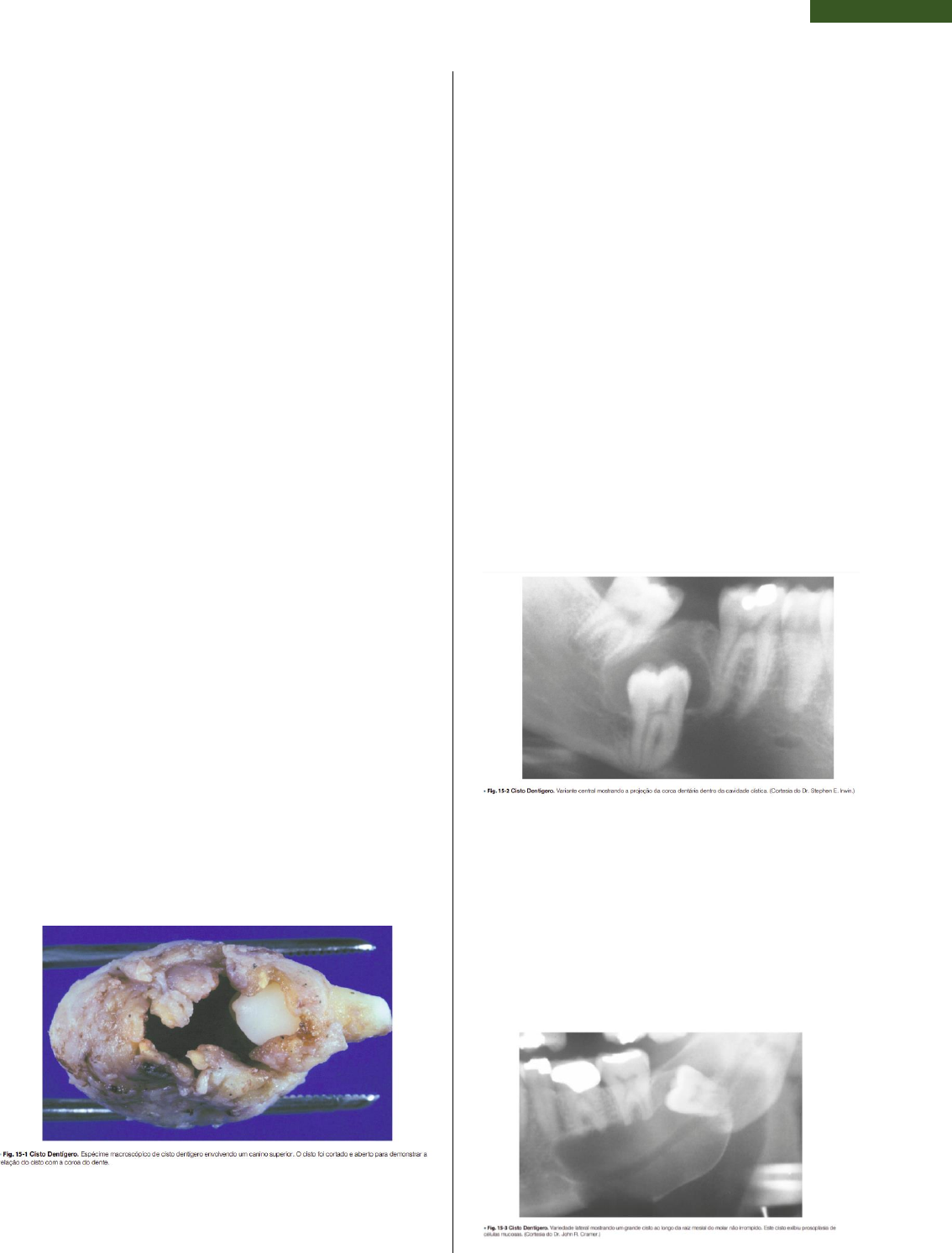 Grátis: Resumo - Tireoide Normal e Patologias - Material Claro e Objetivo  em PDF para Estudo Rápido, image size:1134x1493