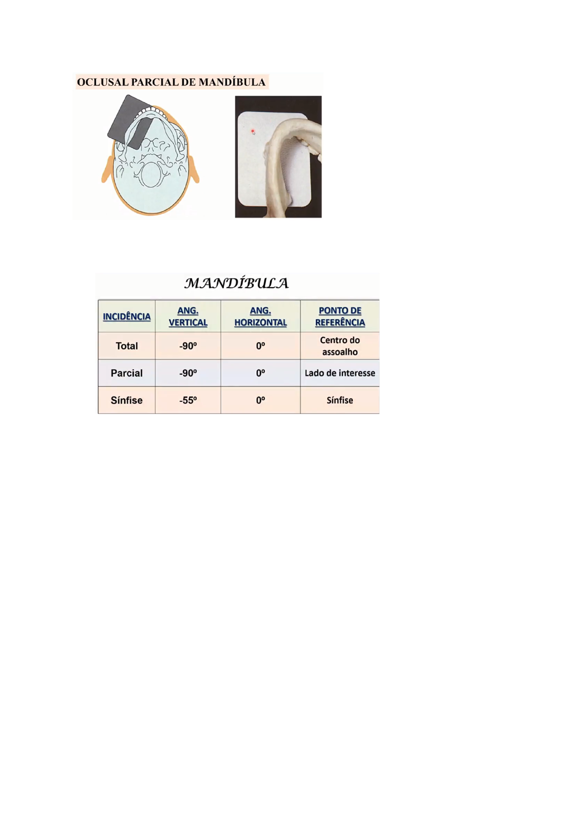 Grátis: TÉCNICAS RADIOGRÁFICAS - INTRAORAIS (periapical, interproximal e  oclusal) - Material Claro e Objetivo em PDF para Estudo Rápido, image size:1191x1684