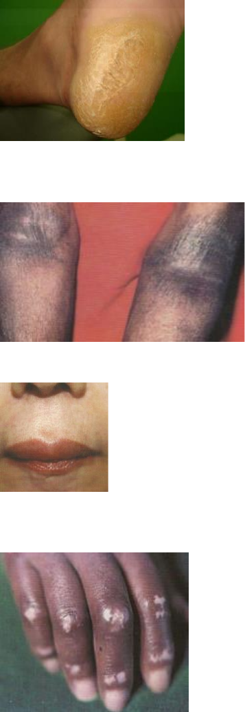 DERMATO - PCI 5p - Dermatologia