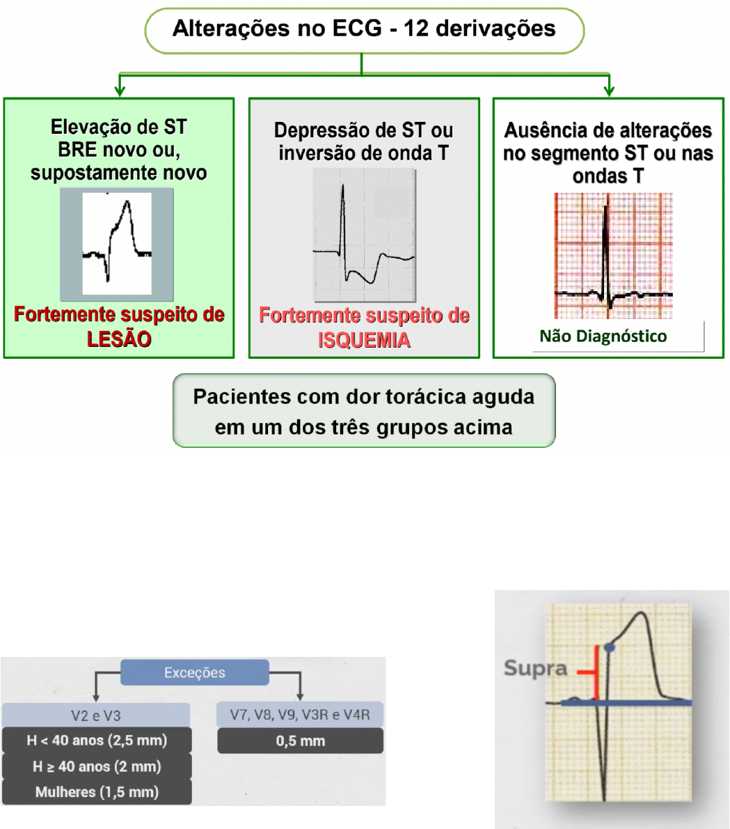 Consulta de ECG! : r/emergencymedicine, image size:1049x1190