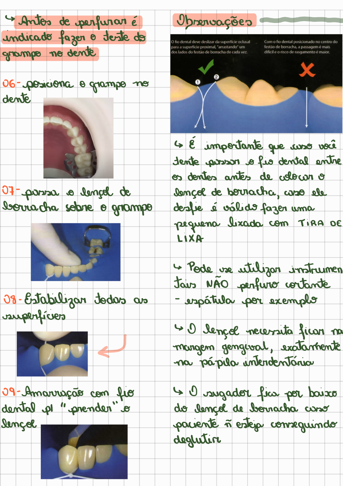 Isolamento absoluto passo a passo - Dentística