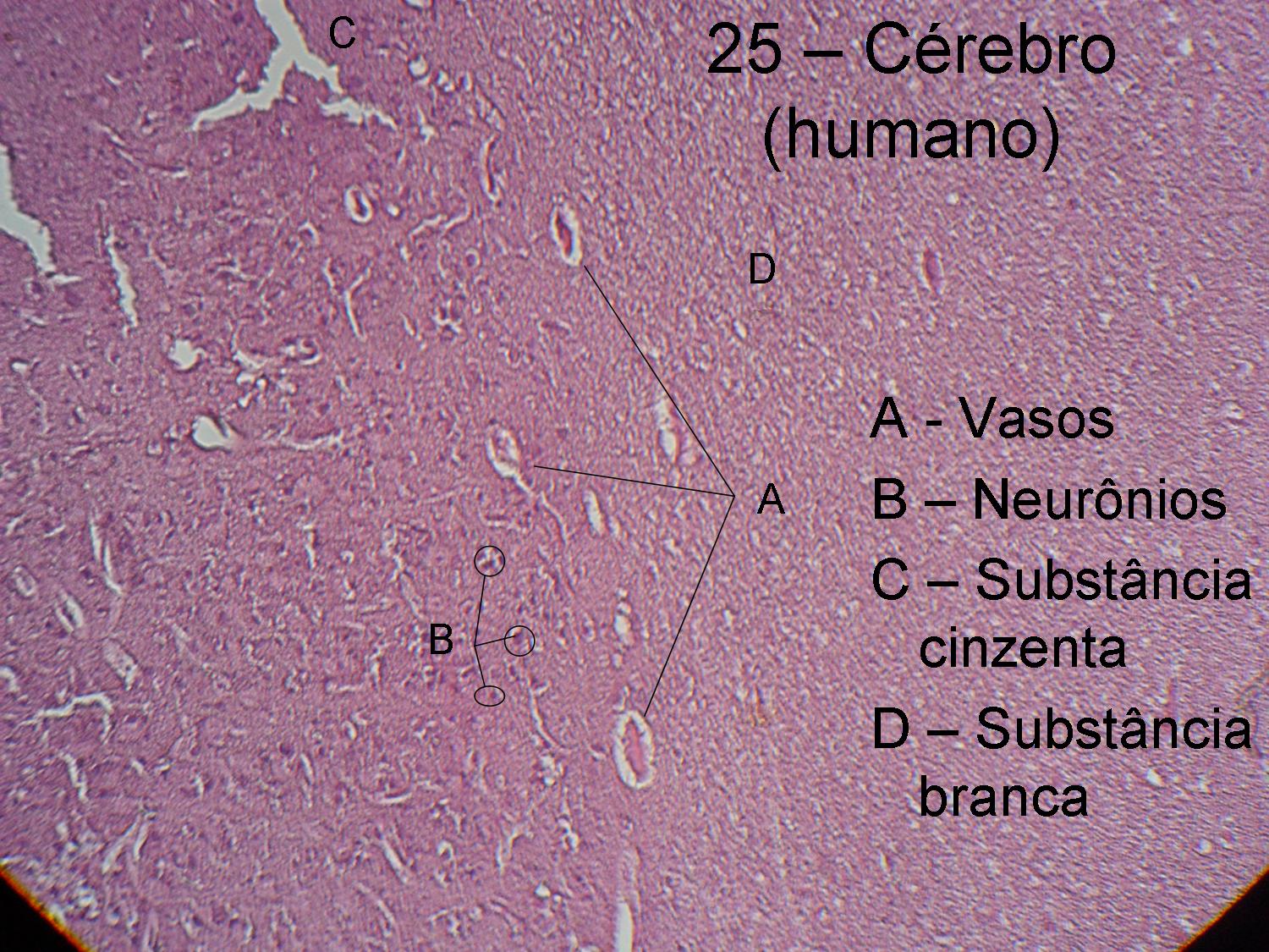 Histologia Del Cerebro Histologia Del Cerebro