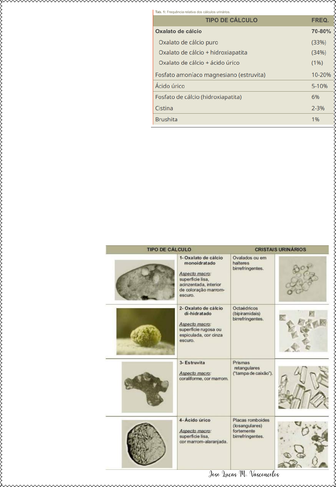 Grátis: Tutoria 4 - Dor, Nefrolitíase, Litíase aguda, Antiespasmódicos, Dor  visceral, Dor irradiada e referida - Material Claro e Objetivo em PDF para  Estudo Rápido