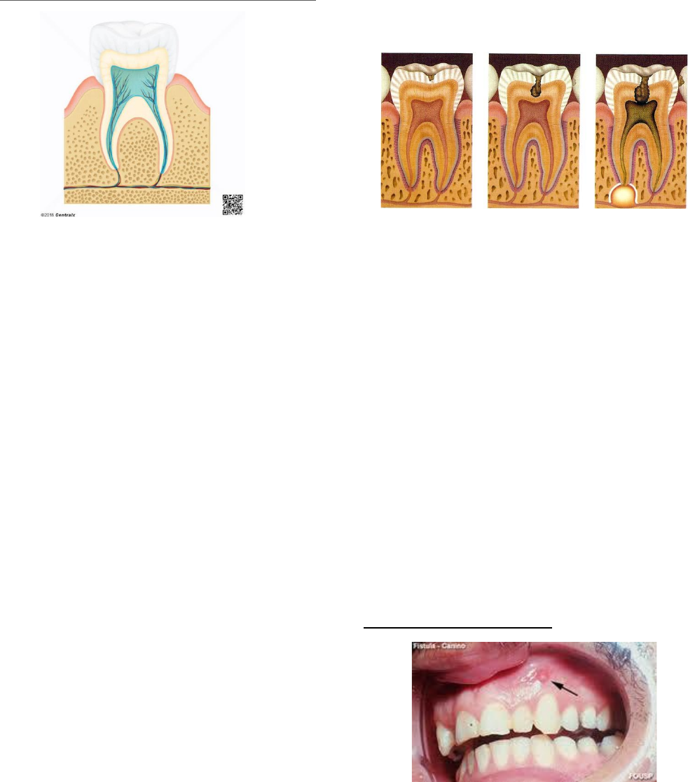 CADERNO DE ENDODONTIA I E II - Endodontia