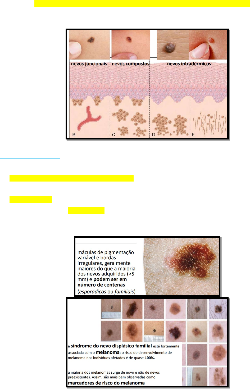Grátis: CÂNCER DE PELE - Melanoma, CBC e CEC - Material Claro e Objetivo em  PDF para Estudo Rápido, image size:945x1470